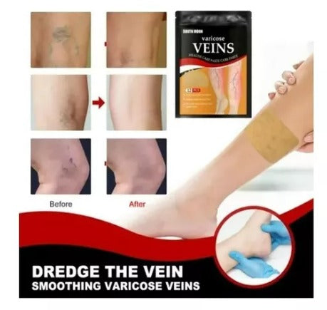 Parches varices x4