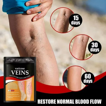 Parches varices x3