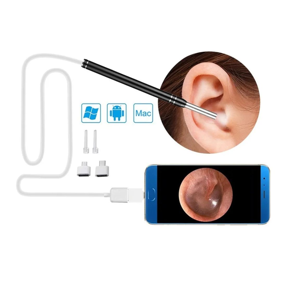 Mini Camara Endoscopio Limpieza Oidos Ot